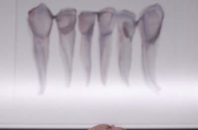 Dentiste à Roissy-en-Brie : Dentifrice à mettre sur la brosse à dents