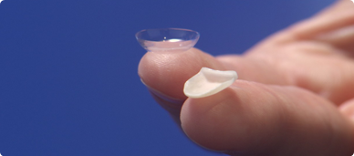 dentiste Seine-et-Marne 77 photo-lumineers