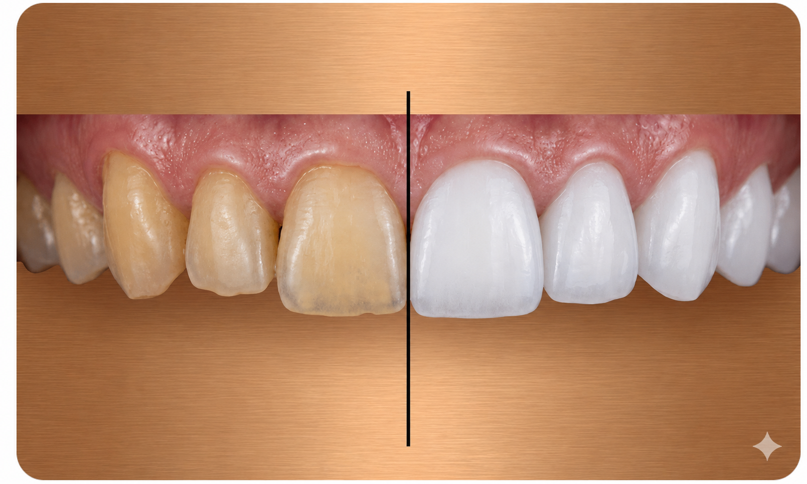 techniques-empreintes-dentaires-optiques-dentiste-roissy-en-brie