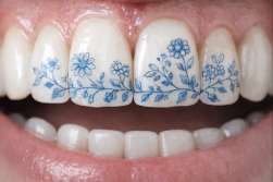 dentiste Roissy-en-Brie